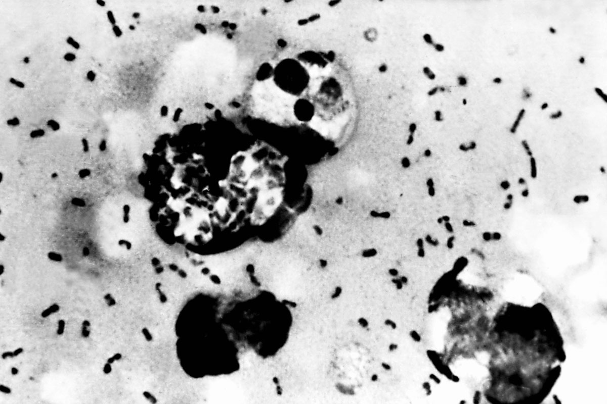 Plague Yersinia pestis