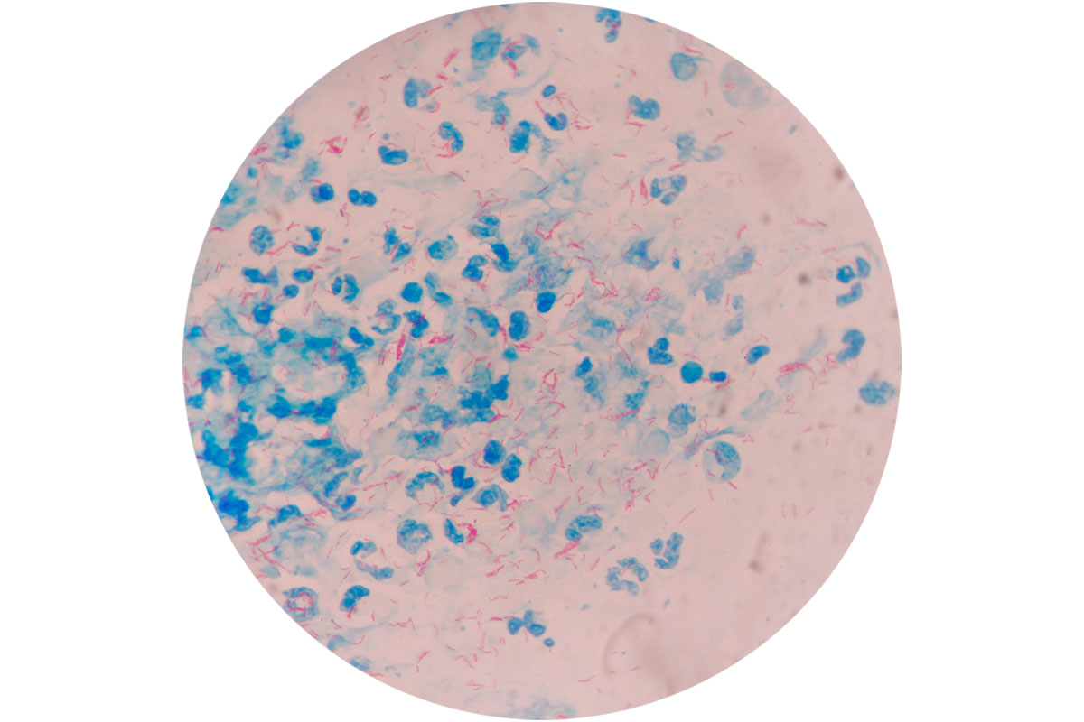 Mycobacterium tuberculosis zem mikroskopa
